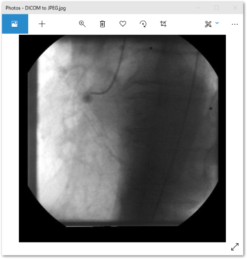 Converti DICOM in JPEG C#