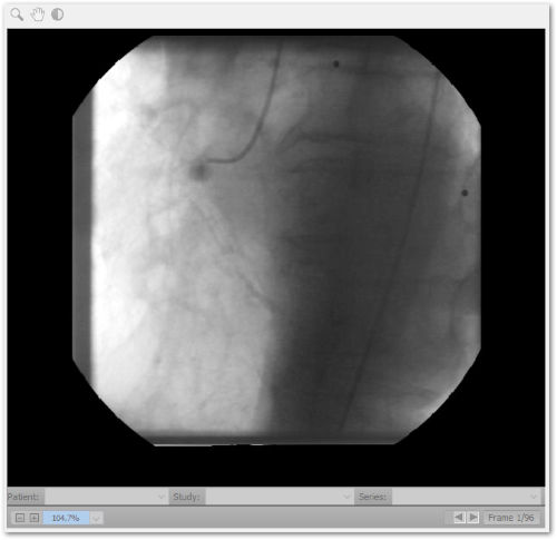 DICOM in JPEG